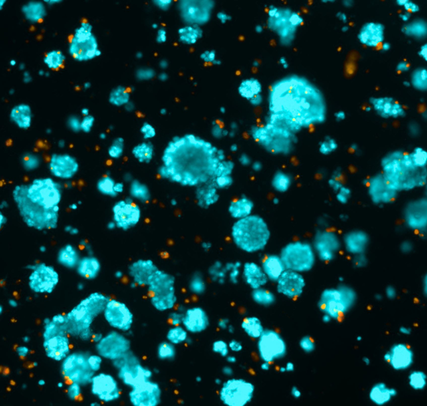 Fluorescence microscopy of hepatocyte spheroids in Glue4Life Liver hydrogel