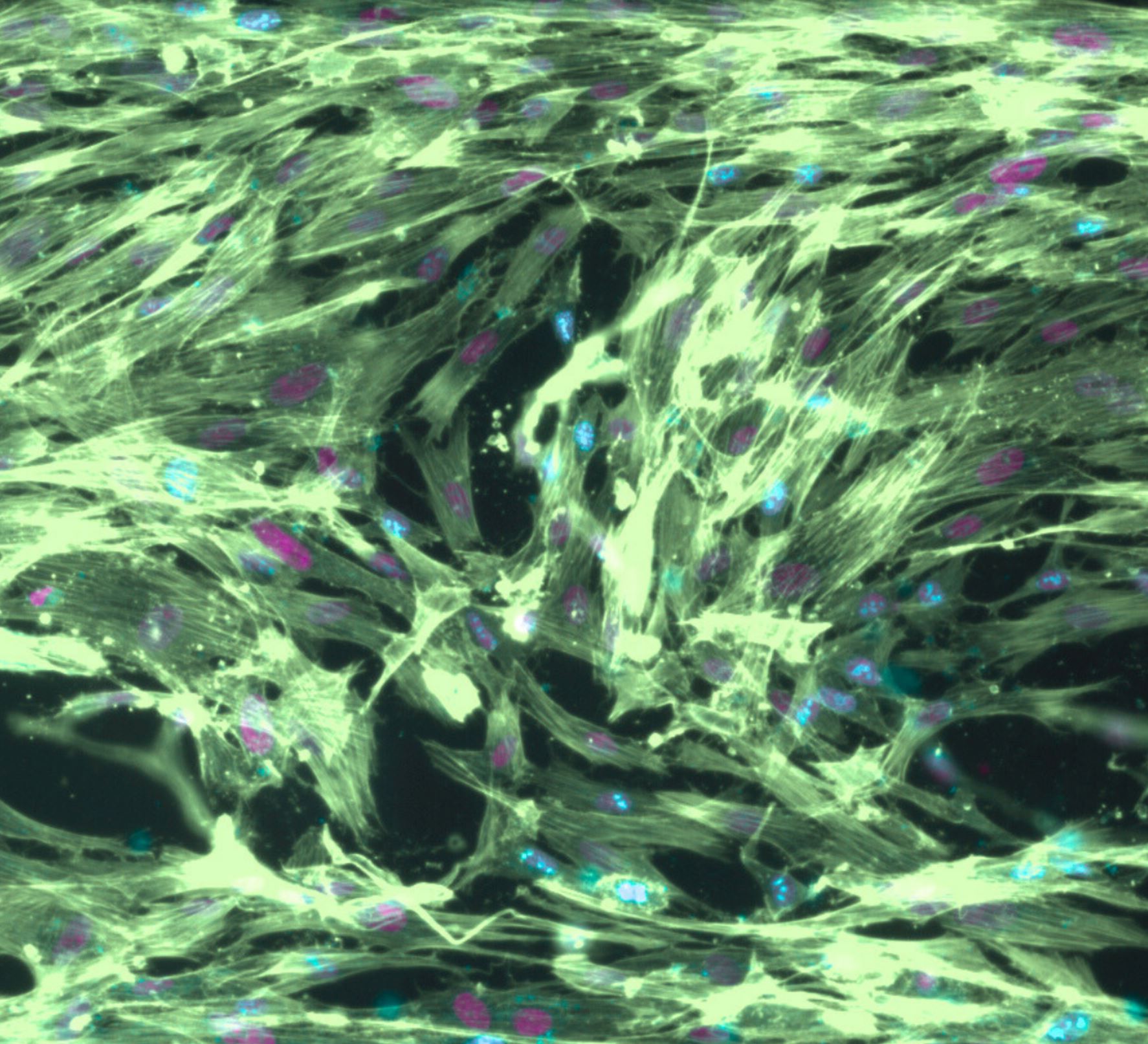 Fluorescence microscopy of mesenchymal stem cells spreading with aligned cytoskeleton in Glue4Life Mese hydrogel