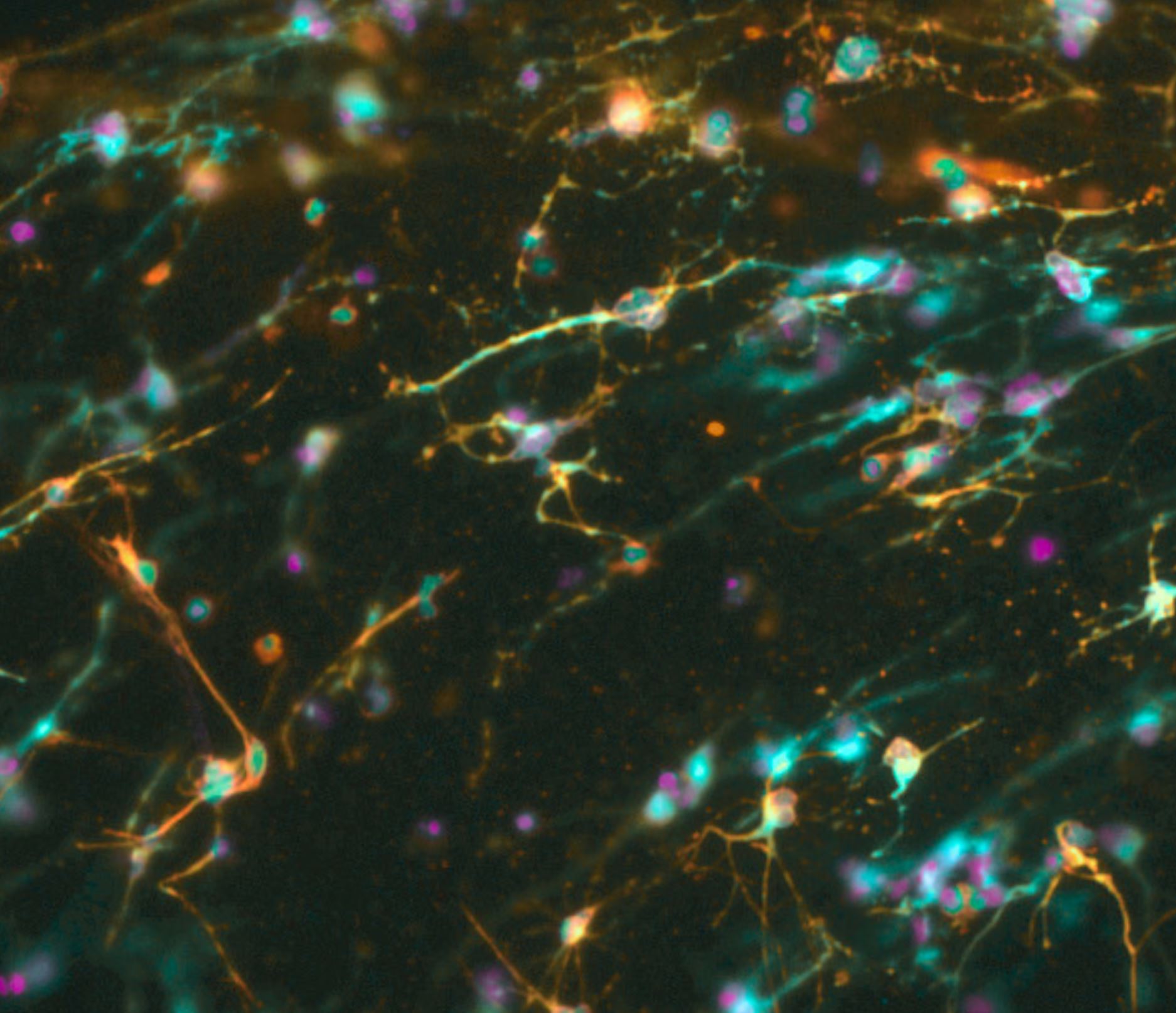 Fluorescence microscopy of hPSC-derived neurons forming a branching neuronal network in Glue4Life Neuro hydrogel