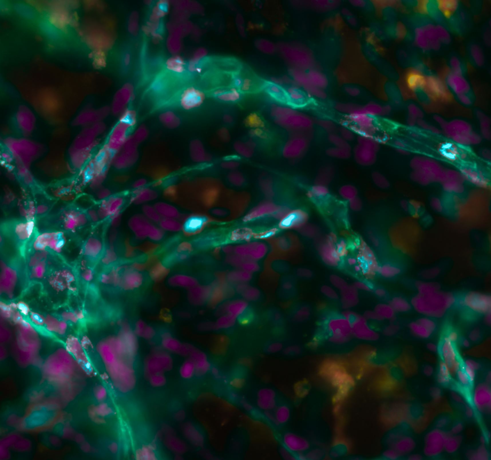 Fluorescence microscopy of HUVEC endothelial cells organizing into vessel-like structures in Glue4Life Vascular hydrogel